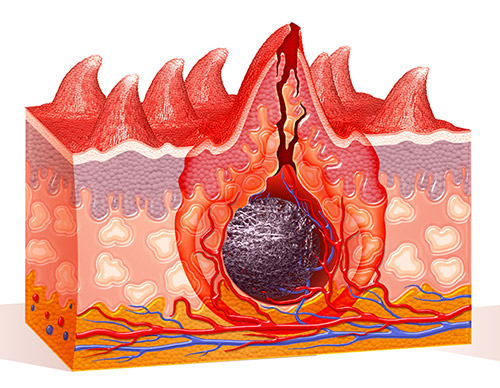 Medical Illustration Enlarged