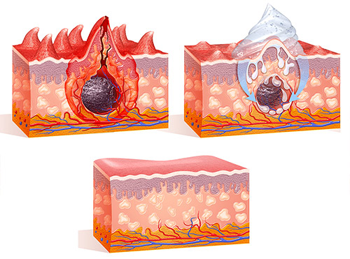 Medical Illustration